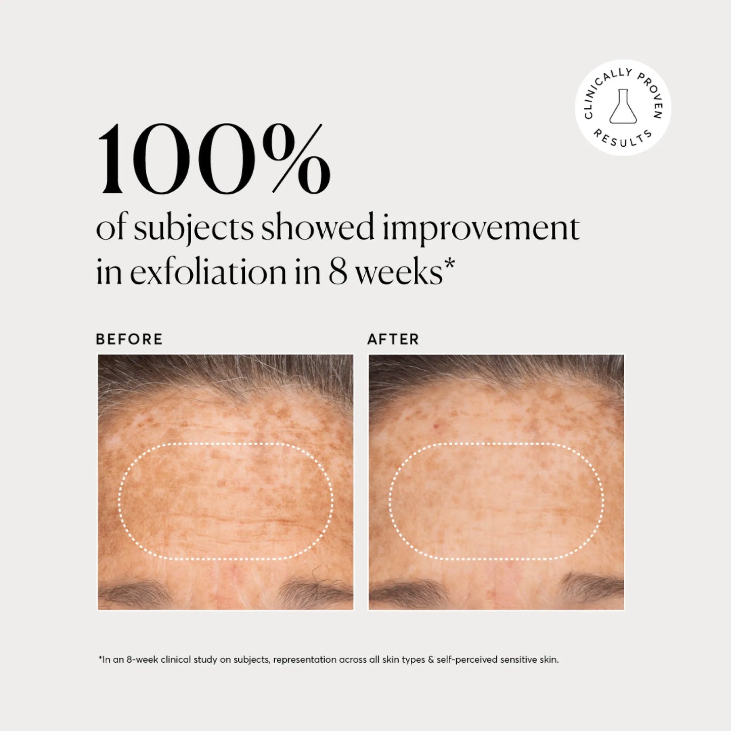 bha-liquid-exfoliant-2-y4 NATR-10027-Alt-Images-BHA-Liquid-Exfoliant-2_-03.webp