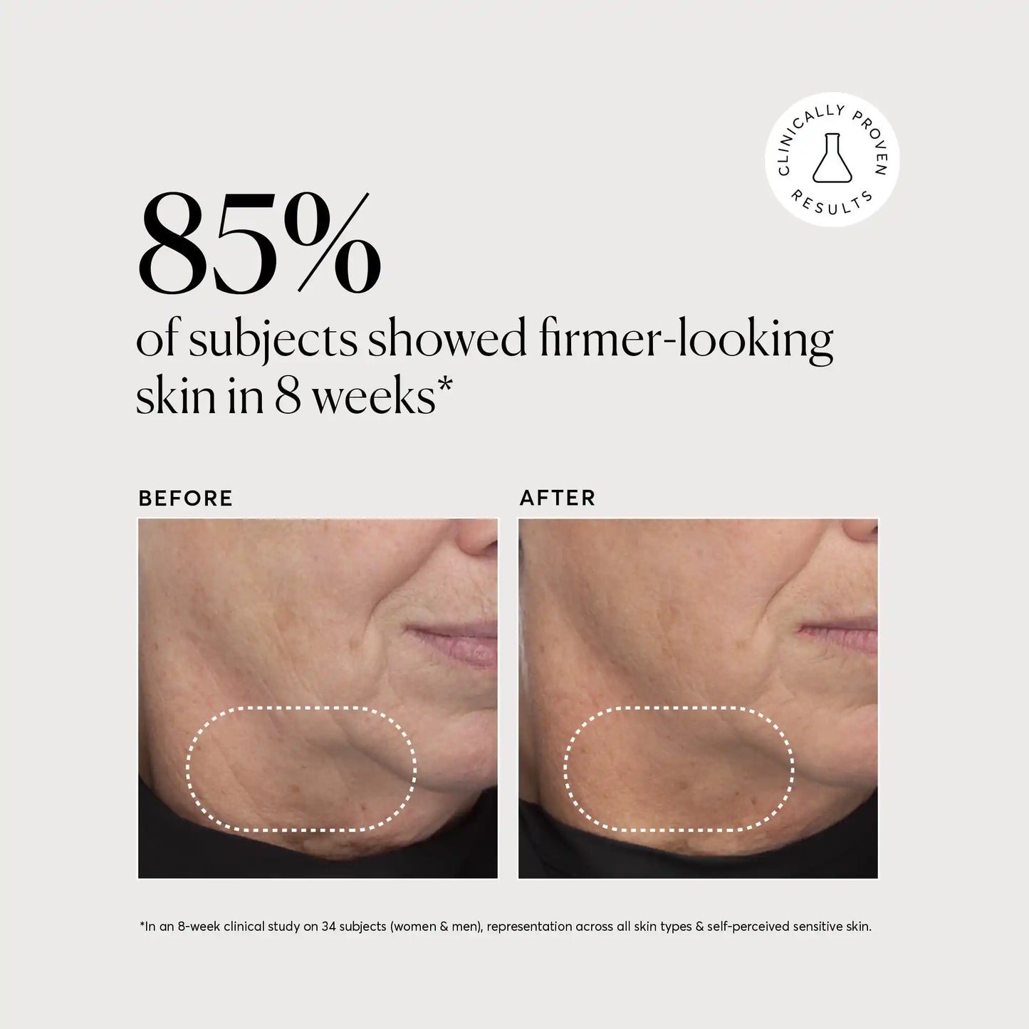 retinol-complex-serum-w6 NATR-10034-Alt-Images-Retinol-Complex-Serum-04.webp